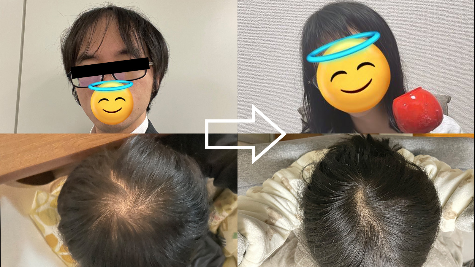 薄毛からロン毛にしたら人生が激変した! 発毛体験記
